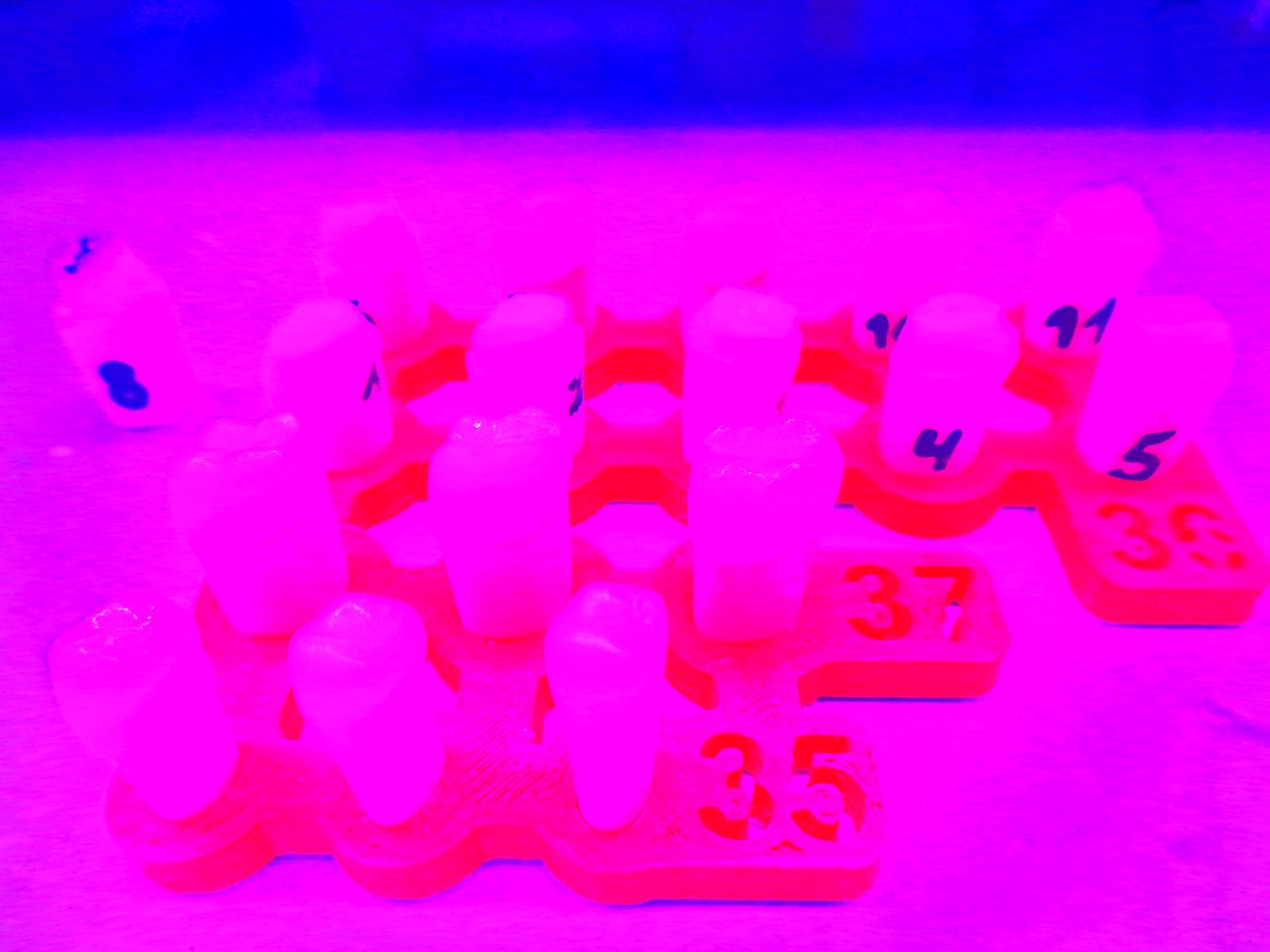 Neon tänder av Martina Konitzky