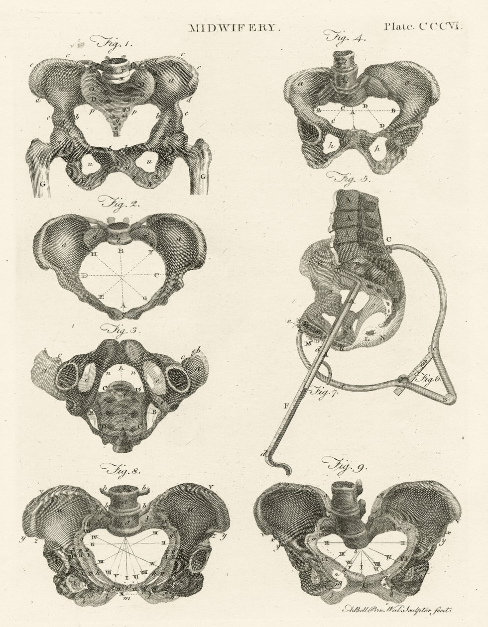 Barnmorskeyrket, illustration från "Encyclopedia Britannica", utgiven i Edinburgh 1798 (kopparstick). av Alexander Bell