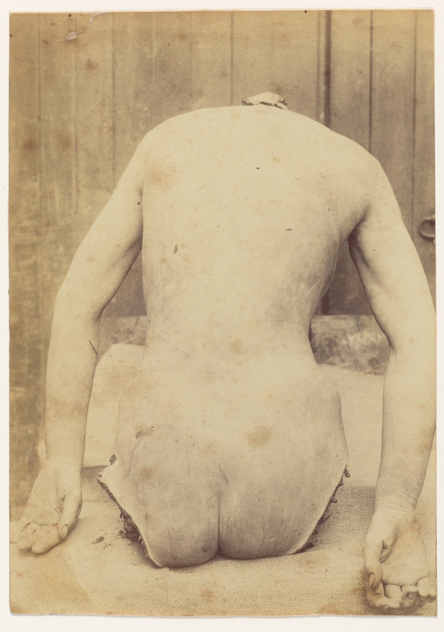 Bakre vy av bagageutrymmet av Alphonse Bertillon