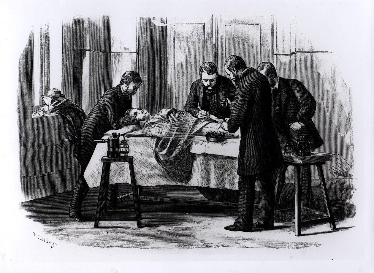 Antiseptisk kirurgi, 1882 av English School