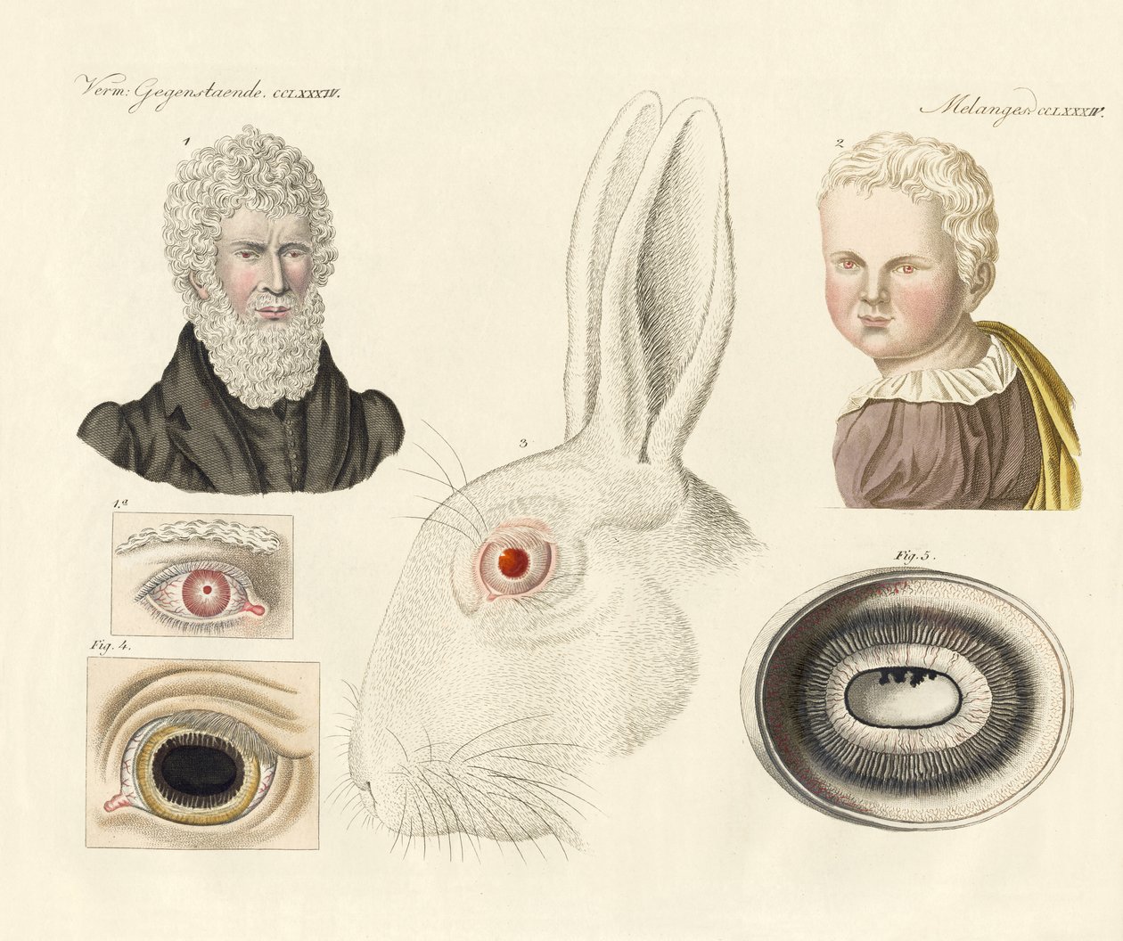 Albinos (färgad gravyr) av German School