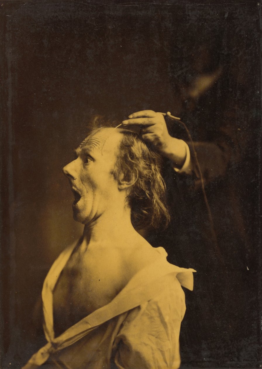 Förvåning, förvåning, häpnad av Guillaume Benjamin Amant Duchenne
