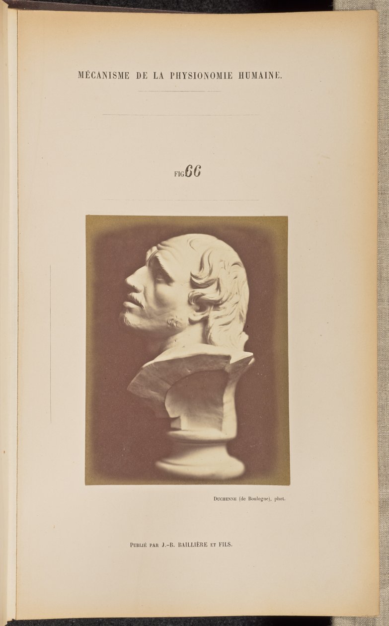 Fig. 66 av Guillaume Benjamin Duchenne