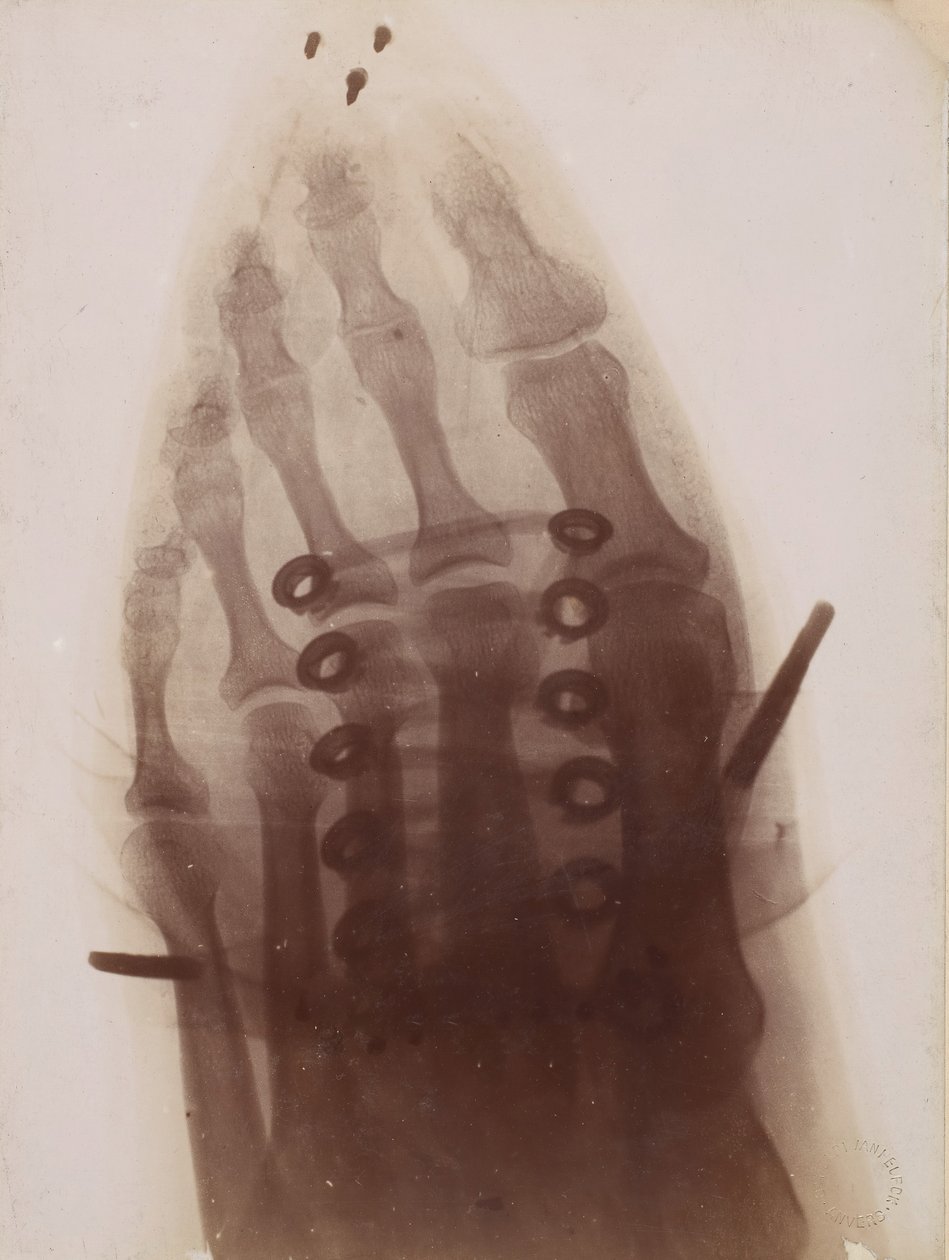 Foten genom skon, 1896. av Henri van Heurck