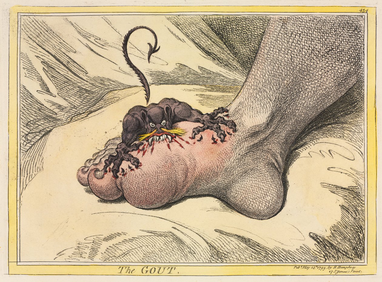 Gikten av James Gillray