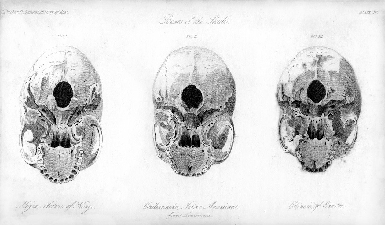 Skallens bas, 1848 av Unbekannt