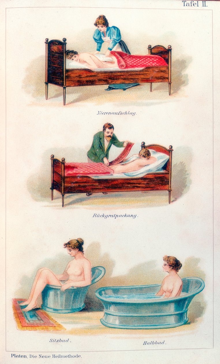 Hydroterapibehandlingar, c1902 av Unbekannt