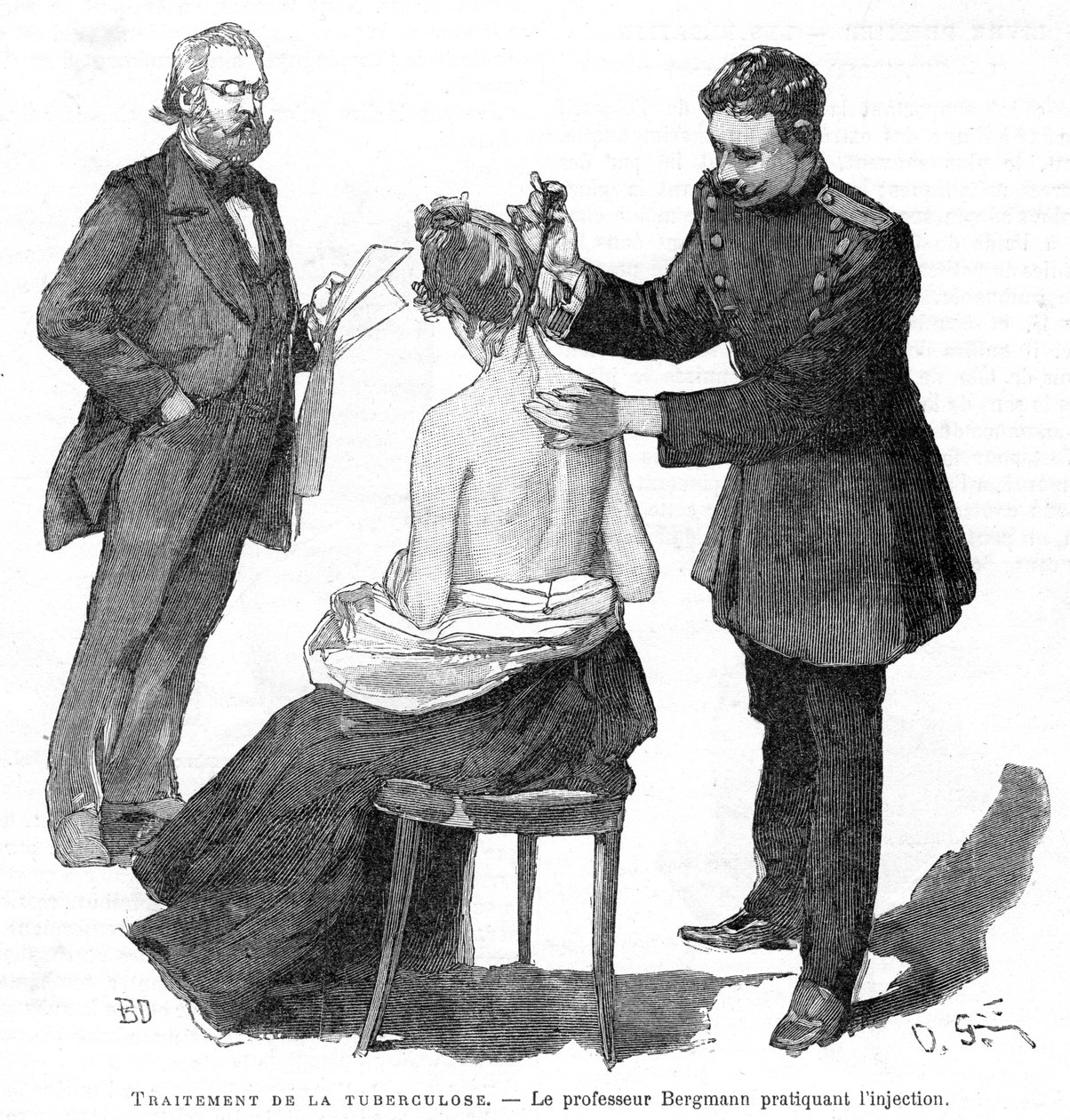 Professor Bergmann injicerar en tuberkulospatient, 1891 av Unbekannt