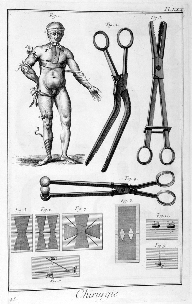 Kirurgi, 1751-1777 av Unbekannt