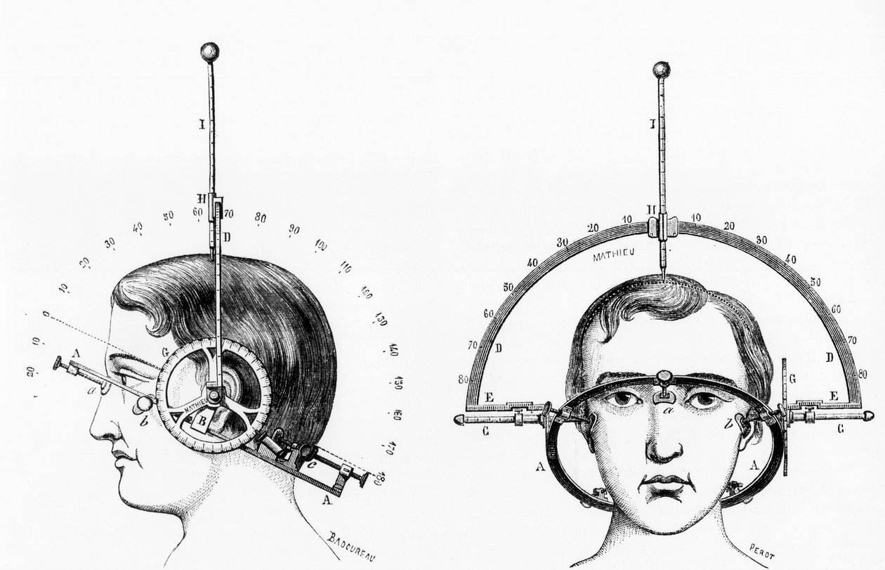 Antropometri Adrien Antelmes cefalometer av Ferdinand Georg Waldmuller