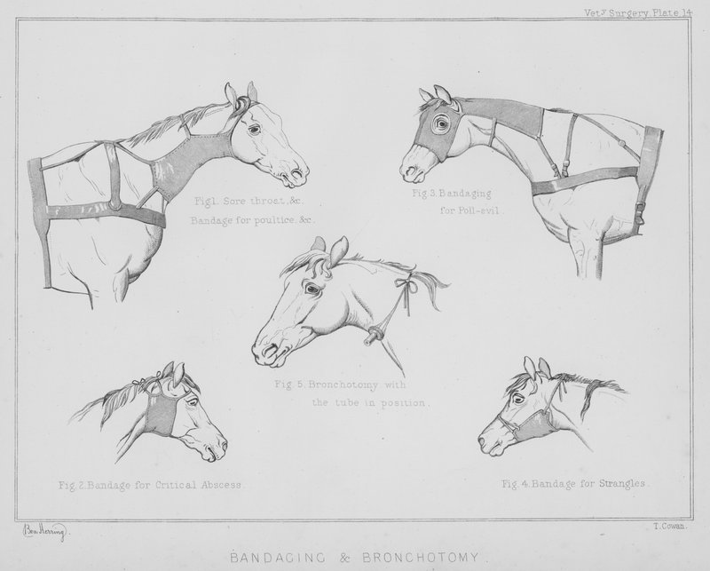 Bandage och bronkotomi (litho) av Benjamin Herring
