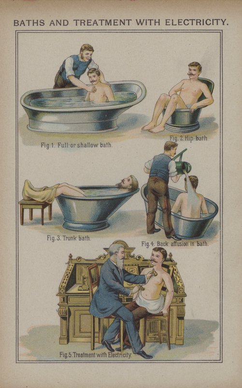 Bad och behandling med el (färg litho) av English School