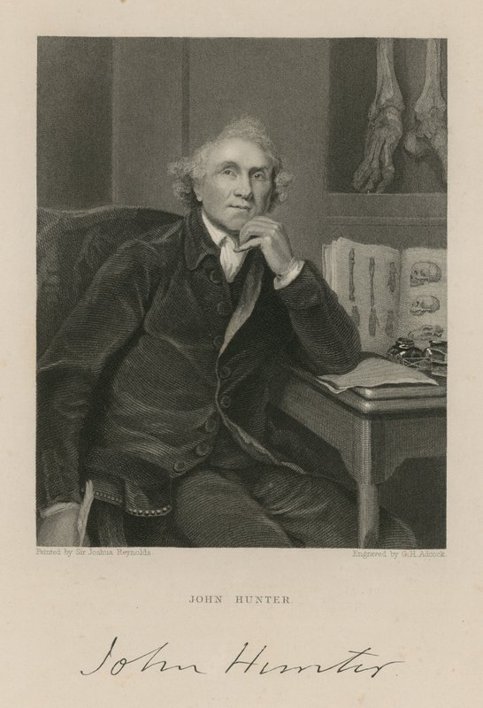 John Hunter av English School