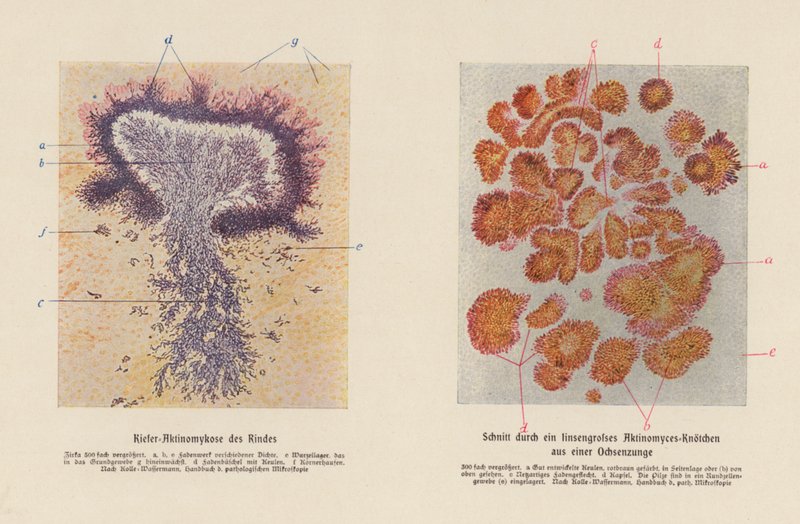 Actinomyces bovis (färglitografi) av German School