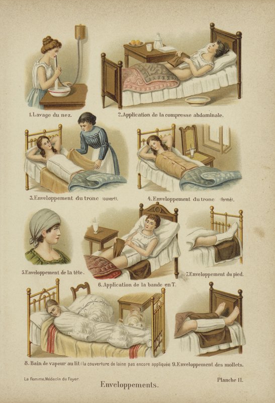 Bandage, omslag och kompresser (färg litho) av German School