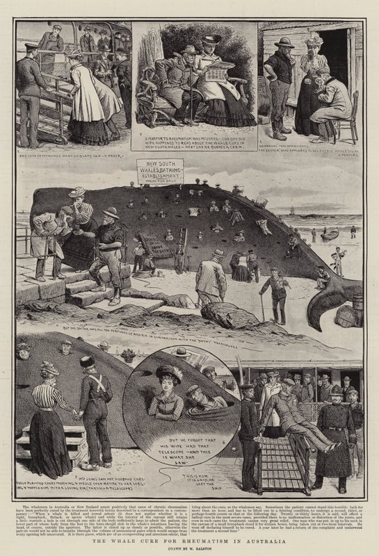 The Whale Cure for Reumatism in Australia av William Ralston